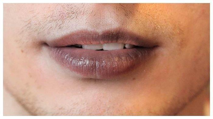 Merawat Bibir Hitam Menjadi Merah Muda Dengan 10 Cara Ini