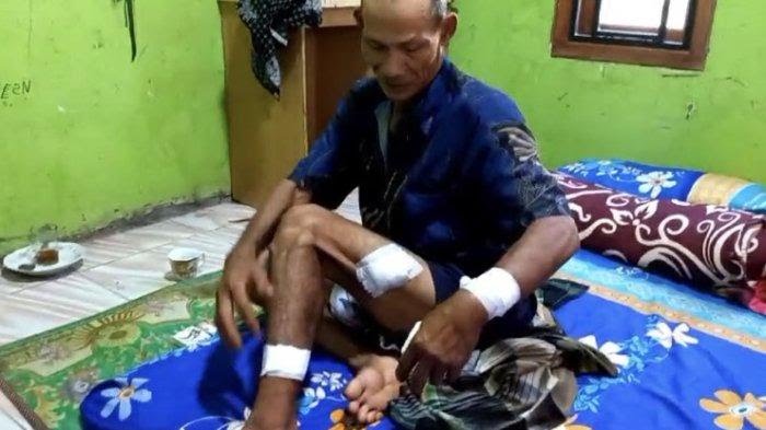 Alami Luka Parah, Kakek di Setu Dibacok Dua Pelaku Begal Hingga Motornya Digasak