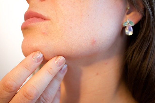 Tips Wajah Bebas dari Jerawat Meski Sering Menggunakan Make Up