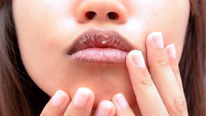 Hal Hal yang Harus dihindari Dalam Merawat Bibir yang Hitam