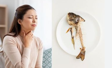 Jangan Makan Buru Buru, 10 Tips Mencegah Duri Ikan Nyangkut Di tenggorokan Dengan Cara Ini