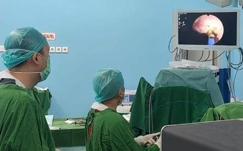 RSUD Karawang Sukses Lakukan Operasi Perdana Thulium Fiber Laser Prostate Enucleation