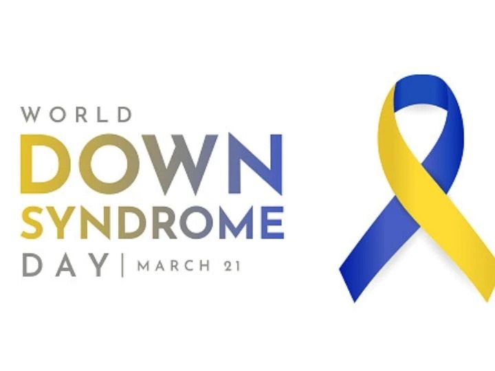 Peringati Hari Down Syndrome, Dokter RSUD Karawang Terangkan Penyakit Penyerta Bisa Diobati