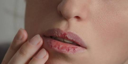 Intip 7 Tips Berikut Ini Jika Kalian Memiliki Bibir Yang Gelap