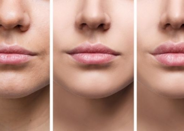 Merawat Bibir Hitam Dengan Menerapkan 5 Perubahan Gaya Hidup ini 