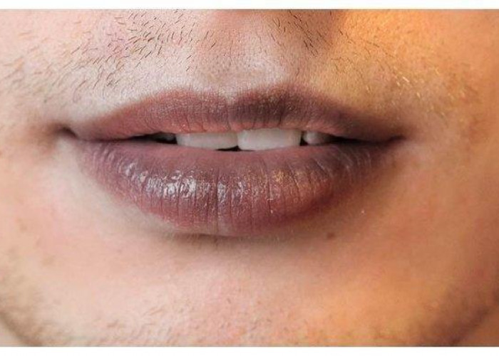 Merawat Bibir Hitam Menjadi Merah Muda Dengan 10 Cara Ini