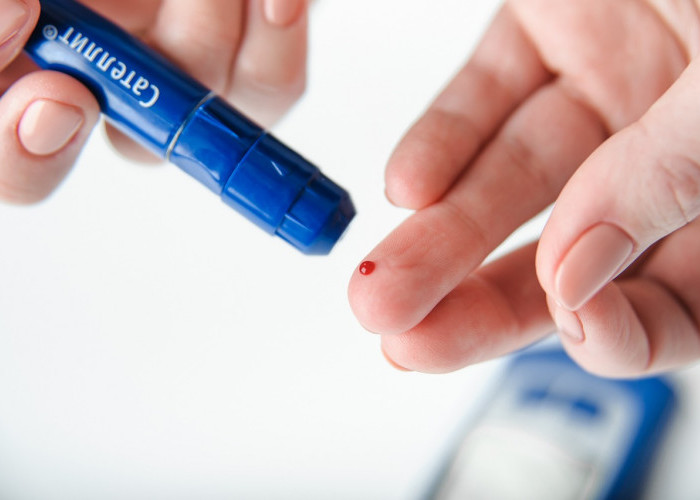 13 Gejala Diabetes yang Muncul di Kulit, Jangan Anggap Sepele karena Bisa Jadi Tanda Gula Darah Tinggi