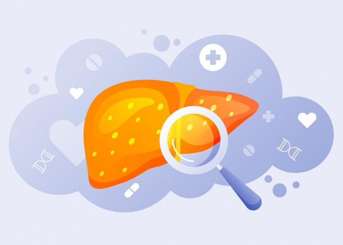 Diam-Diam Mematikan! Penyakit Liver Ini Sering Tak Disadari, Waspada Sebelum Terlambat