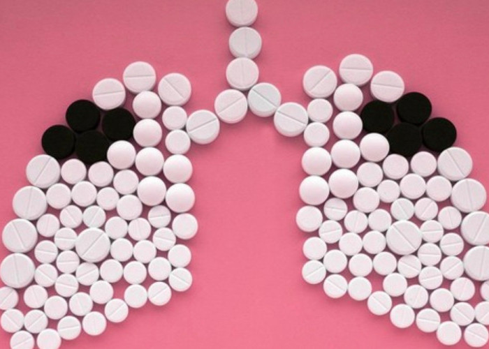 Kasus TBC di Kabupaten Kuningan Meningkat, Warga Diminta Waspada