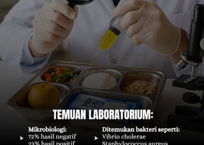 Ini Jenis Bakteri Penyebab Siswa di Bekasi Sakit Perut Usai Santap Program Makan Bergizi Gratis