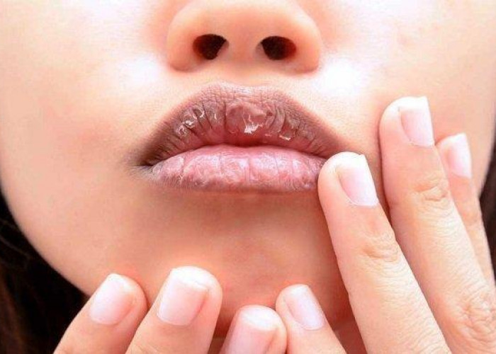 Hal Hal yang Harus dihindari Dalam Merawat Bibir yang Hitam