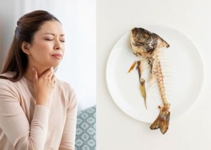 Jangan Makan Buru Buru, 10 Tips Mencegah Duri Ikan Nyangkut Di tenggorokan Dengan Cara Ini