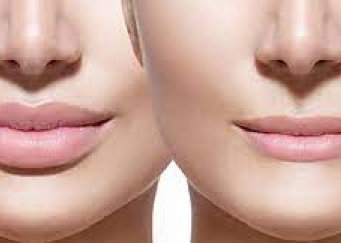 7 Cara Mengecilkan Bibir Secara Alami Tanpa Bantuan Medis 