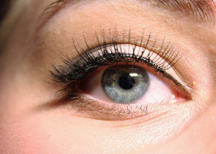 Kenali Penyebab Kantung Mata Bengkak, Hati-hati Bisa Karena Infeksi lho