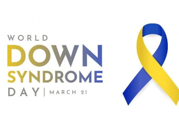 Peringati Hari Down Syndrome, Dokter RSUD Karawang Terangkan Penyakit Penyerta Bisa Diobati