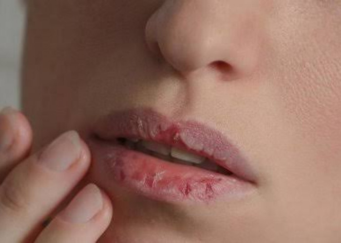 Intip 7 Tips Berikut Ini Jika Kalian Memiliki Bibir Yang Gelap