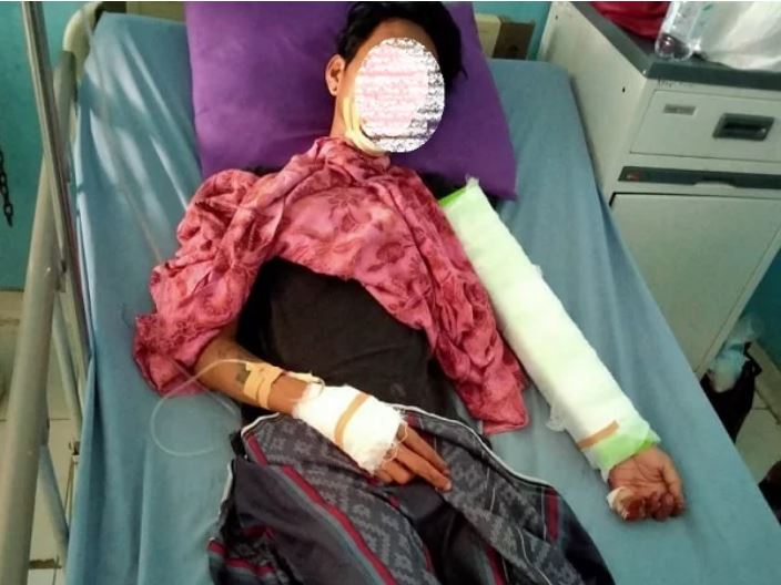Brutal, Rombongan Geng Motor AS Mengamuk, 2 Warga Terluka Parah Kena Sabetan Celurit