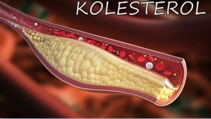Asal Muasal Kolesterol, Pemicu Penyakit Mematikan