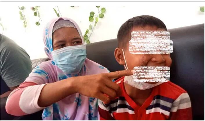 Heboh!, Anak SD Dianiaya Tetangganya, Muka Ditempelkan ke Knalpot Panas