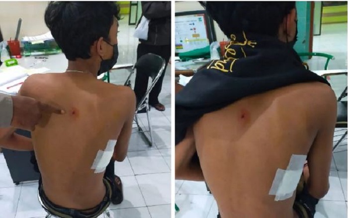 Kejadian Apes Menimpa AM, Pulang Dini Hari, Dibacok Gerombolan Klitih