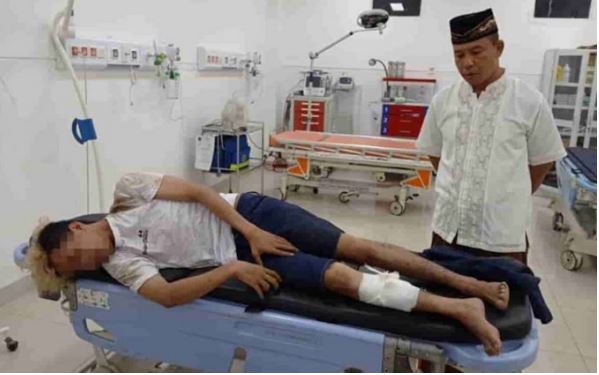 Berusaha Kabur saat Ditangkap, MR Dihadiahi Timas Panas, Tuh Liat Kakinya Bolong