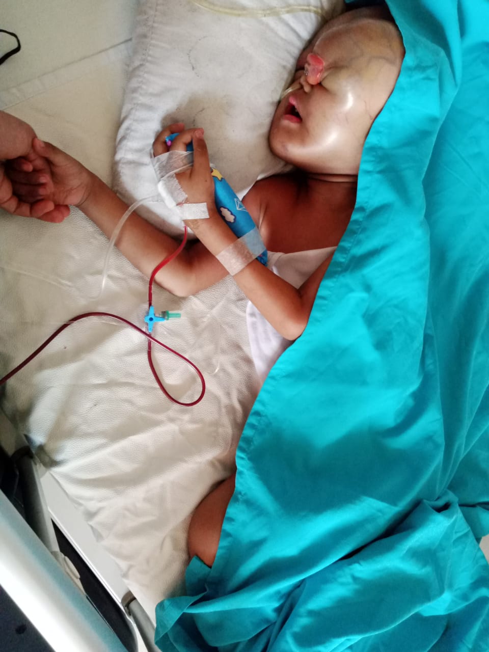 Kisah Balita Karawang Abdullah Rifky Mumtaz Mengidap Kanker Neuroblastoma, Ibunda: Belum Ada Perhatian dari Pe