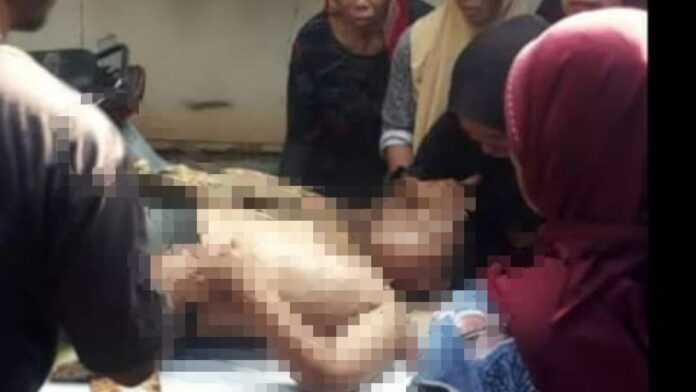 HP Meledak di Dada, Bocah Ini Tewas dengan Luka Bakar